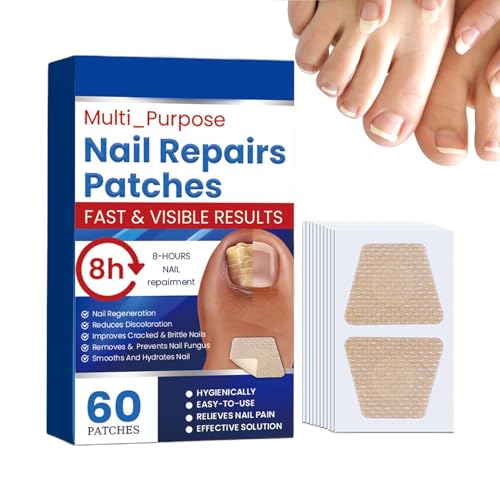 Patches de uñas, pegatina de reparación de uñas de 60 piezas extra fuerte durante la noche, parches de uñas de mano efectiva para hombres Restauración de recuperación de mujeres