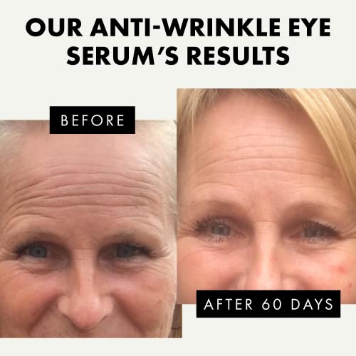 Retinol Eye Serum For Dark Circles And Puffiness - Eye Serum With Collagen, Aloe Vera, Vitamin C & E - Under Eye Wrinkle Repair - Dark Eye Circle Remover - Eye Depuffer - Eye Lifting And Firming Serum #TOP2