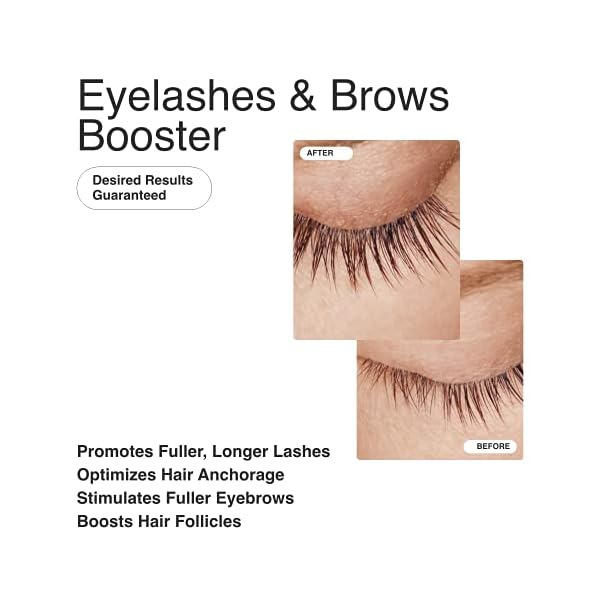 MATKAS Korean Gentle Lash Serum for Eyelash Growth - Eyelash Serum To Grow Lashes Stronger, Thicker, Healthier Eye Lash, Eyelash Growth Serum - Panthenol, Niacinamide, Amino Acids, Vitamin E, Peptides