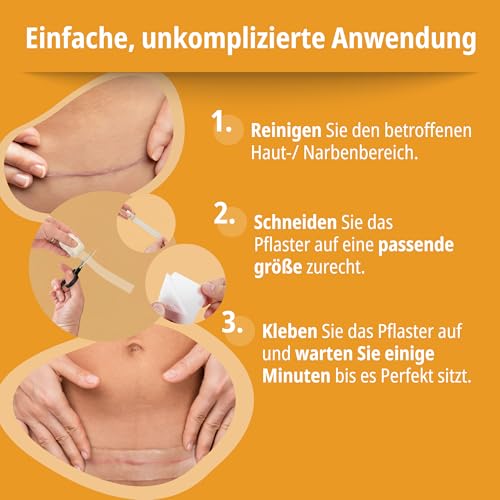 Evolsin® Silikon Narbenpflaster transparent – Ideal für Kaiserschnitt & OP-Narben (200cm)