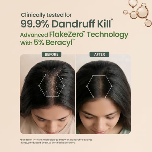 Image of Nat Habit Anti-Dandruff Navdha Shampoo | Clinically Proven 99.9% Dandruff Removal | FlakeZero Technology with 5% Beracyl | Neem, Green Tea & Bhringraj | Sulfate & Silicone Free | 250ml