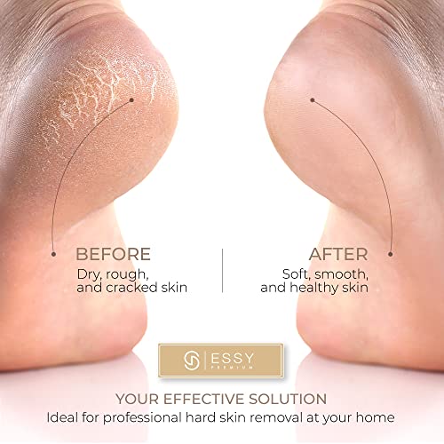 Electric-Foot-File-Pedicure-Feet-Hard-Skin-Remover-Foot-Scraper-Dry-Dead-Skin-Remover-Callus-Exfoliator-Rechargeable-Feet-Scrubber-with-5-Replacement-Rollers-Foot-Care-Skin-Removers