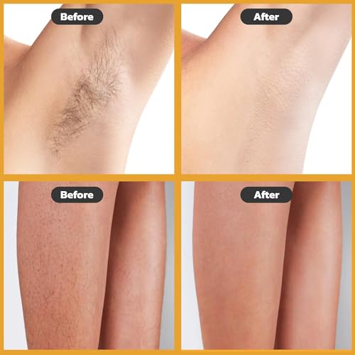 Image of Hair Removal Wax Kit Wax Heater Machine Roll on Hair Removal Wax Kit Wax Heater machine,Refill Cartridge Strips With Wipes Waxing kit for Women Waxkit (wax Roller Heater Machine Combo) (6)