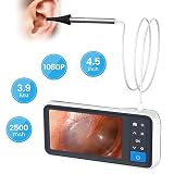 ROTEK Otoscope, Ear Camera 2.0 Megapixels Digital Otoscope 1080P HD Mini Ear Sco...