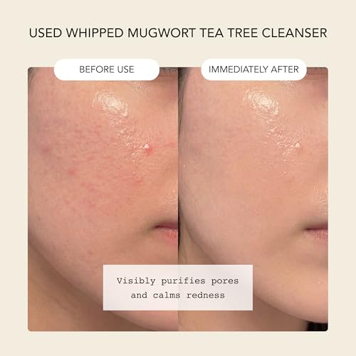 Image of Whipped Korean Skincare Face Wash, Doubles as a Face Mask, Mugwort Tea Tree, Deep Cleansing Vegan Facial Cleanser for Oily Skin and Pore Care with Matcha, Centella Asiatica, Niacinamide