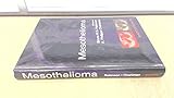 Mesothelioma