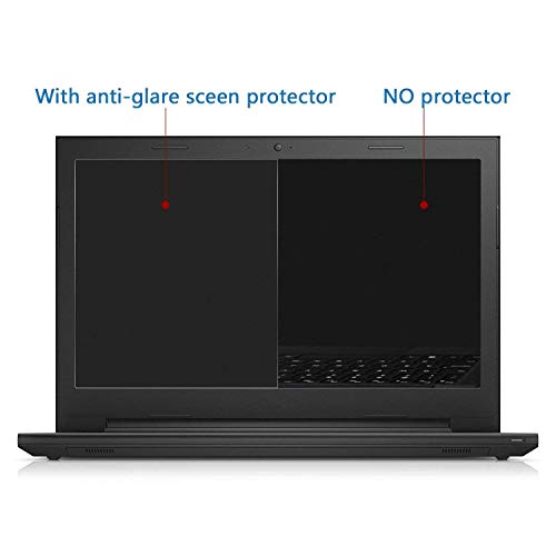Image of Saco Anti Glare Scratch Ultra-Clear Screen Protector for Dell Vostro 3558 (Intel Pentiem Dual Core 5th Gen / 4 GB / 1 TB HDD / 15.6 / Dos)