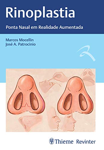Rinoplastia: Ponta Nasal em Realidade Aumentada