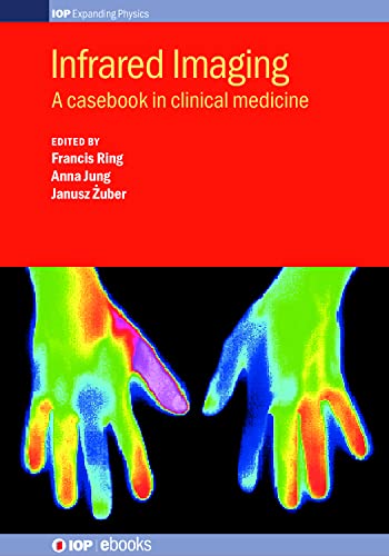 Infrared Imaging: A casebook in clinical medicine (IOP Expanding Physics) (English Edition)
