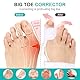 Naapesi 2 Stück Hallux Valgus Korrektur, Hallux Valgus Schiene für Damen und Herren, Verstellbarer Zehenspreizer Hallux Valgus Toe Spacer zur Schmerzlinderung, Tag & Nacht Tragbar (Universalgröße)