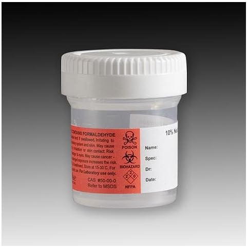 Globe Scientific 6527FL Pre-Filled Container, 120mL, PP, Filled with 60mL of 10% Neutral Buffered Formalin, Attached Hazard Label, Pack of 96