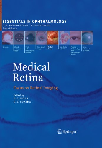 Medical Retina: Focus on Retinal Imaging (Essentials in Ophthalmology) (English Edition)