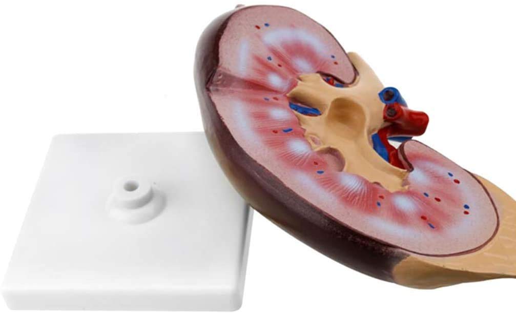 Istituzione Medica Educativo Modello Medico Modello Anatomico Modello Anatomico Modello Umano del Rene Rene per L'Assistenza di Formazione, Materiale di Laboratorio