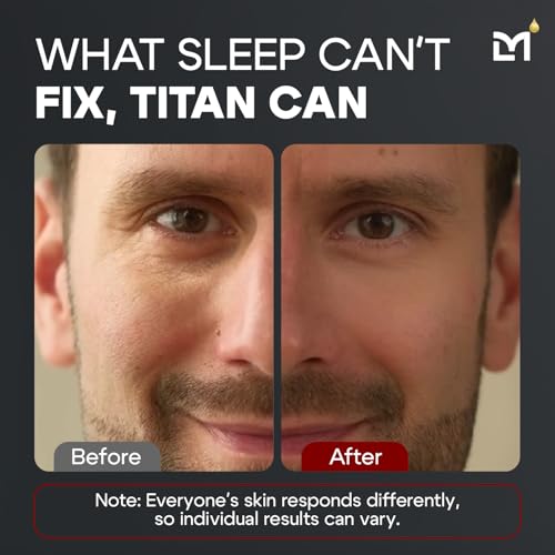 Man Labs Titan Mens Eye Cream Anti Aging for Dark Circles Under Eye Treatment – Eye Bags Treatment for Men – Under Eye Bag Remover – Crows Feet Eye Wrinkle Cream – Peptides & HA – All Skin – Unscented