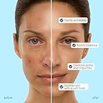 MAREE Face Exfoliator — Microdermabrasion Facial Scrub & Exfoliating Face Wash for Women — Collagen & Glycolic Acid — Gentle Scrub and Exfoliant — Men Exfoliating Scrubber — Exfoliante Facial Cleanser - Image 3