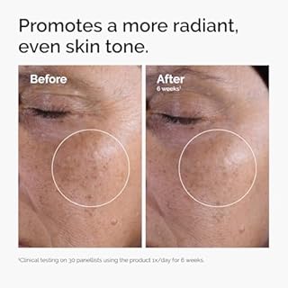 The Ordinary Glycolic Acid 7% Exfoliating Toner, Brightening and Smoothing Daily Toner for More Even-Looking Skin Tone, 3.4 Fl Oz