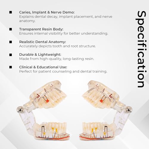 Image of iDENTical Patient Education Model (Caries, Implant, Nerves) M2001-3 | 3D Model | Featuring More than 30 Clinical Findings | Illustrative | Durable | Portable