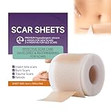 Thoquene 4 x 150cm Silikonpflaster für Narben, Wiederverwendbar Narbenpflaster Silikon, Silicone Scar Tape