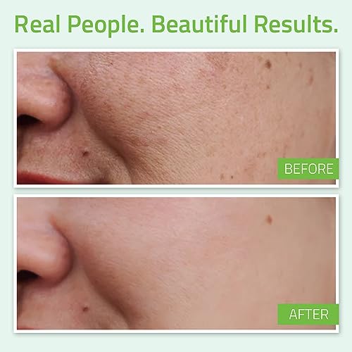 YEOUTH Hyaluronic Acid Serum for Face with Vitamin C, Hydrating Serum, Minimize the Look of Wrinkles, Patchy & Dull Skin, Face Serum for Women & Men 2oz - Image 5