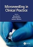 Microneedling in Clinical Practice (English Edition)