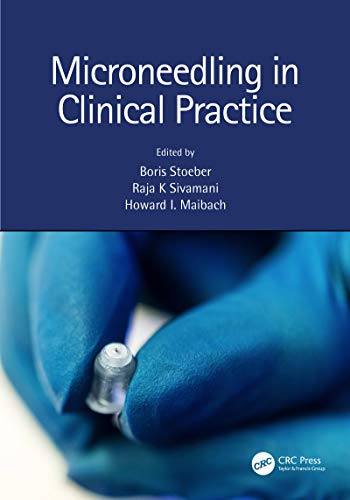 Microneedling in Clinical Practice (English Edition) - Stoeber, Boris