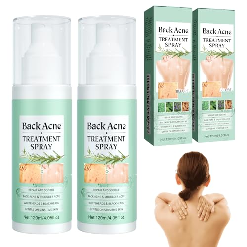 Spray para el acné y la espalda, 2 unidades de spray para el acné, antiespinillas y espalda, limpieza profunda, spray de tratamiento para el cuerpo, pecho y espalda, suave para la piel