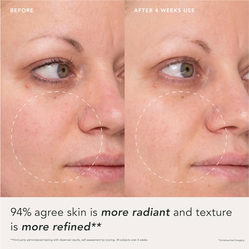 RANAVAT-Imperial-Glow-Refining-Lotus-Gel-Creme-Hydrating-Gel-Moisturizer-Pore-Minimizer-Improves-Radiance-Texture-with-Hyaluronic-Acid-Floral-Ketoacids-17-oz