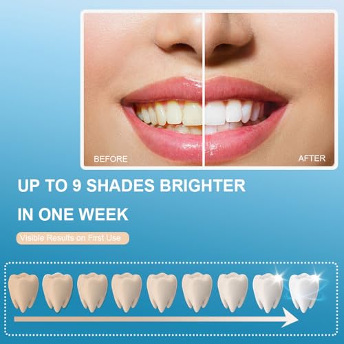 Image of RVEYi Teeth Whitening Kit for Sensitive Teeth with LED Light, 35% Carbamide Peroxide Gel Syringes and Remineralizing Gel, Blue