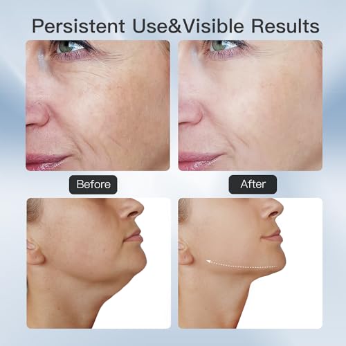 3-in-1 beauty massager for face and neck based on triple action led thermal and vibration technologies for skin careimprovefirmtightening and smooth