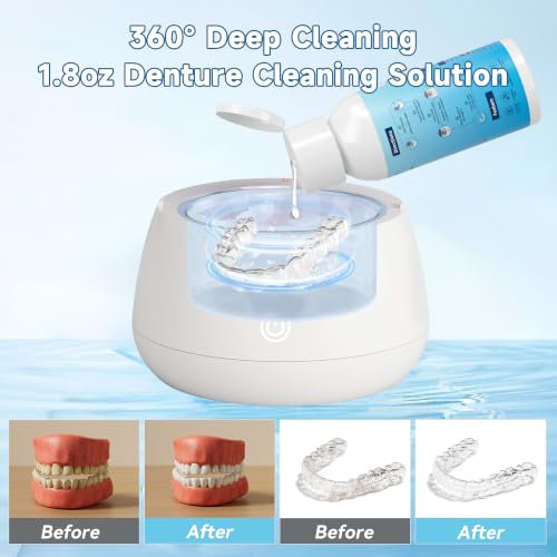Image of Ultrasonic Retainer Cleaner Solution for Ultrasonic Denture Cleaner-Professional Cleaning of Retainers, Invisible Aligners, Mouth Guards, Night Guards, Remove Odors, Discoloration & Stains 1.8oz