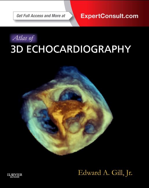 Atlas of 3D Echocardiography: Expert Consult – Online and Print