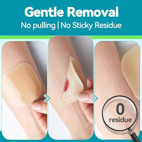 Image of Dimora 4 inch x 4 inch Hydrocolloid Dressing Tapered Edges for Wound Care, 10 Pcs Large Hydrocolloid Bandages for Burn, Blister, First Aid Kit Essential Wound Dressing