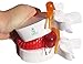 Doc.Royal Anatomical Human Lumbar Vertebrae Degenerative Lumbar Human Spine Model 1PCS