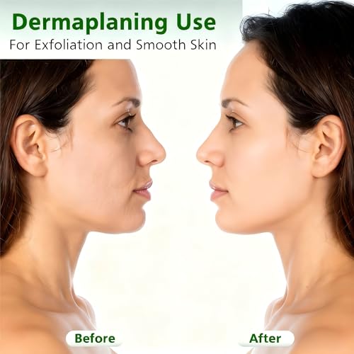 La Mejor Recopilación de Bisturíes los 10 mejores. 17 Imagen adicional