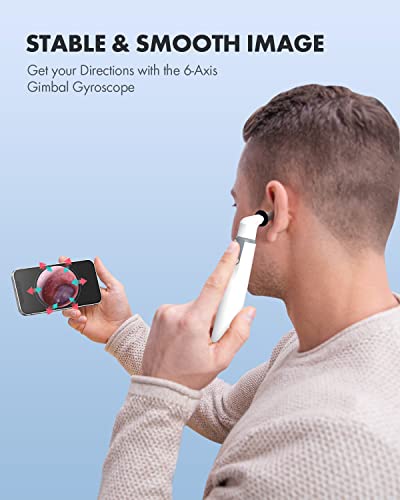 Anykit-Wireless-Otoscope-Ear-Camera-with-Dual-View-39mm-720PHD-WiFi-Ear-Scope-with-Ear-Wax-Removal-Tool-for-Kids-and-Adults-Pets-Compatible-with-Android-and-iPhone