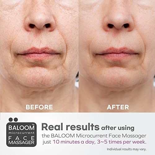 Baloom Microcurrent Facial Massager - Skin Tightening Care For Women And Men - Face/Body Wrinkle Removal, Anti Aging, Skin Rejuvenation, Face Lift, Acne Spot Treatment - 10 Minutes A Day. #TOP2