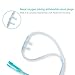 Luisddi 10 Pack High-Flow Soft Nasal Oxygen Cannula, Standard Connector 7 Ft, Green Tubing and Each Individual Packing