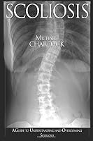 Scoliosis: A Guide to Understanding and Overcoming Scoliosis 1543011837 Book Cover