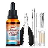 XIFEPFR Ingrown Toenail Kit, Ginger Ingrown Toenail Treatment, Drops with Tools for Big Toe Ingrown Pain Relief, Toenail Clippers For Thick & Ingrown Nails, Ingrown Toenail Removal Kit