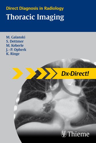 Thoracic Imaging: Direct Diagnosis in Radiology (Dx-Direct)