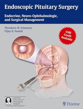 Endoscopic Pituitary Surgery: Endocrine, Neuro-Ophthalmologic, and Surgical Management book cover