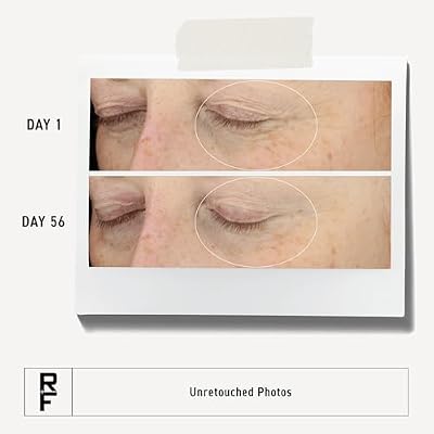 RODAN + FIELDS Redefine Eye Cream | 15 ml | Vitamin C & F Moisturizer for Hydrated, Radiant Eyes | Supports Younger Looking Eyes | Smooths Puffiness