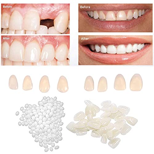 DBSUN 2in1 Teeth Veneers and Thermal Beads ReplacementKit.Used to Repair Missing Broken Teeth and Gaps-A Realistic Looking Fix for A Missing Or Broken Tooth.