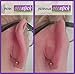Otostick Cosmetic Ear Correctors