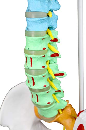 Vision Scientific Vav245 Flexible Spinal Column | 5 Color-Coded | Muscle W Occipital Bone | Sacrum, Coccyx, 24 Vertebrae, Soft Disc | Pelvic Bones & Femur Heads, Arteries, Nerve Endings | W Manual #TOP4