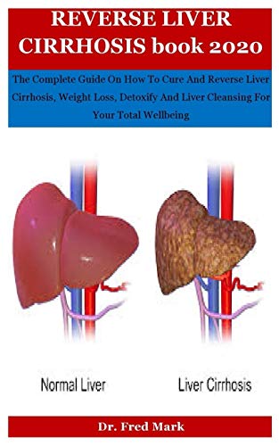 Reverse Liver Cirrhosis Book 2020: The Complete Guide On How To Cure And Reverse Liver Cirrhosis, Weight Loss, Detoxify And Liver Cleansing For Your Total Wellbeing