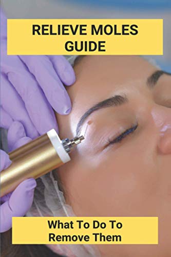 Relieve Moles Guide: What To Do To Remove Them: Getting Rid Of Moles In The Yard