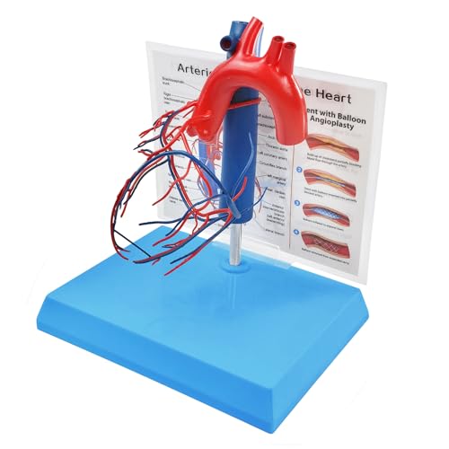 Image of NEW HORIZON Human Heart Model Vascular Heart, Naturally Size, with base Increased sized coronary anatomy depicting the cardiac veins