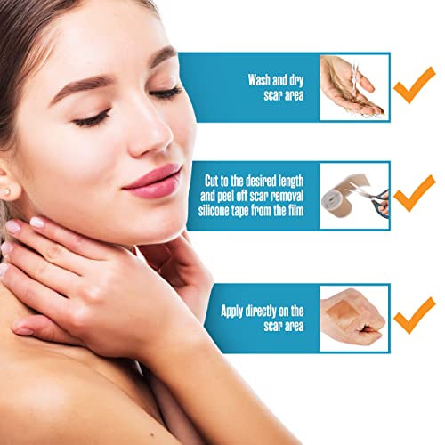 Silicone Scar Sheets, Soft Gel Tape, 1.57” X 60”, With 2” Perforations, Tan, Flexible, Medical Grade For Surgery, Keloids, Burns, Sensitive Skin, Wound Protection, Healing Patch | Houseables #TOP6