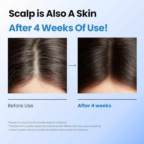 scalpy hair growth serum for men amp women for hair loss amp thinning  scalp treatment with salicylic acid menthol dexpanthenol  non-greasy lightweight  exfoliates dandruff amp soothes itch